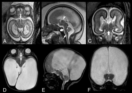 Fig 2.