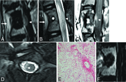 Fig 3.
