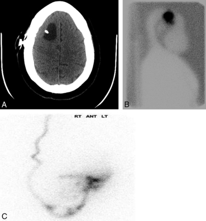 Fig 1.