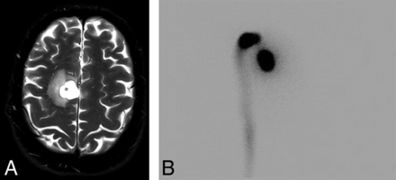 Fig 2.