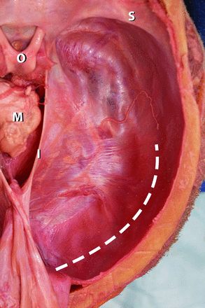 Fig 1.