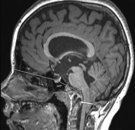 Fig 2.