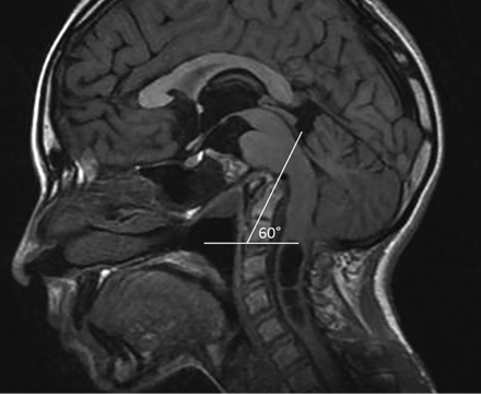 Fig 3.