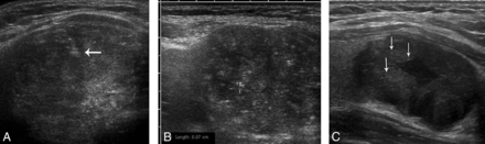 Fig 1.