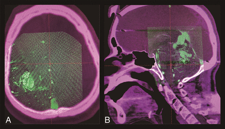 Fig 1.