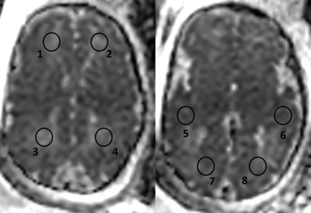 Fig 1.
