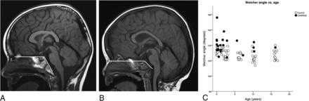 Fig 2.