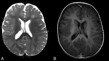 Fig 2.
