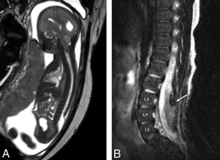 Fig 2.
