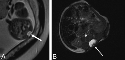 Fig 3.