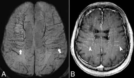 Fig 1.