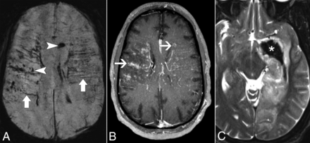 Fig 3.