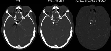Fig 1.