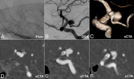 Fig 3.