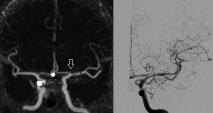 Fig 5.