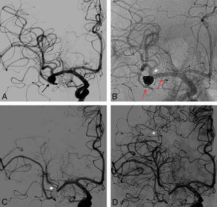 Fig 2.