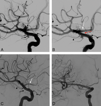 Fig 3.