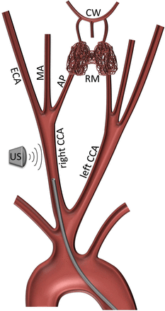 Fig 1.