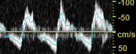 Fig 3.