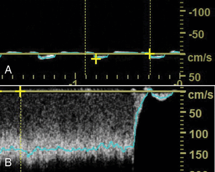 Fig 4.