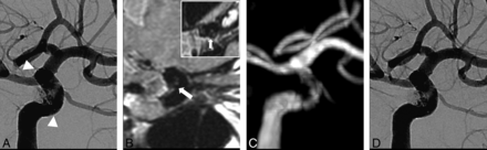 Fig 1.