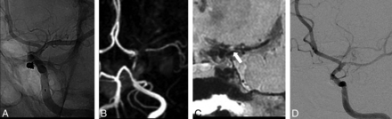 Fig 2.