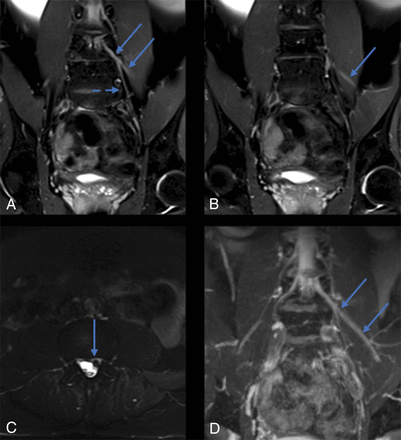 Fig 3.