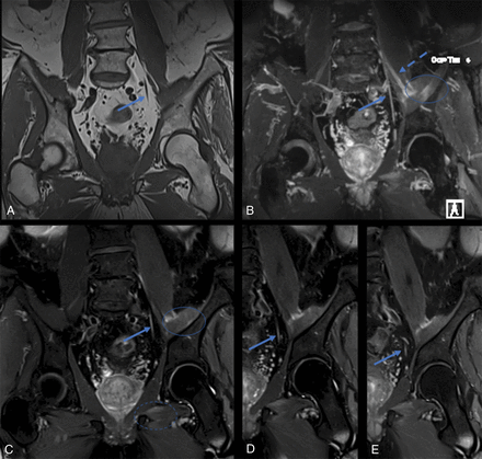 Fig 5.