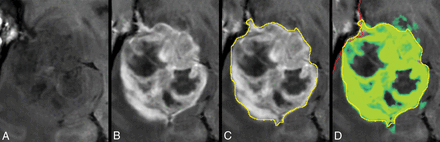 Fig 4.
