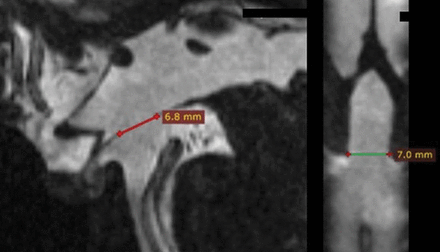 Fig 1.