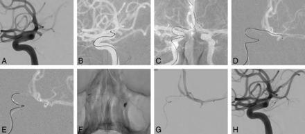 Fig 2.