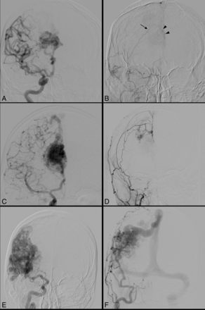 Fig 1.