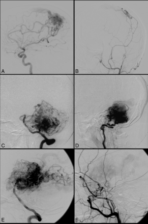 Fig 5.