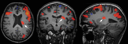Fig 3.