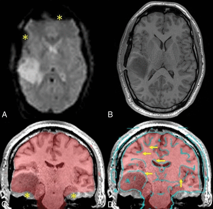 Fig 1.