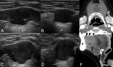 Fig 3.