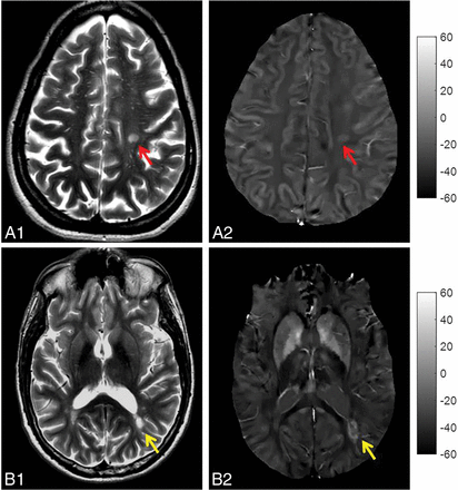 Fig 1.