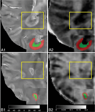 Fig 5.
