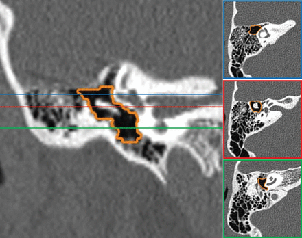 Fig 4.