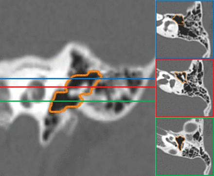 Fig 5.