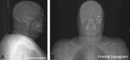 Fig 1.