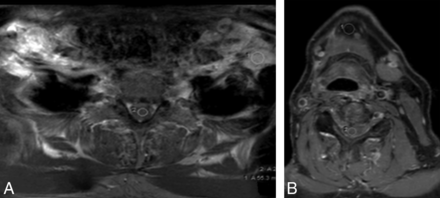 Fig 2.