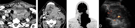 Fig 2.