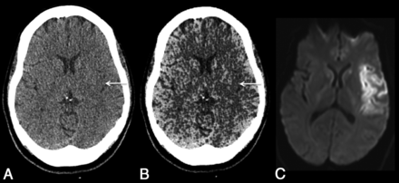 Fig 5.