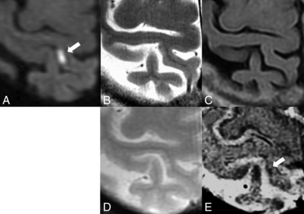 Fig 2.