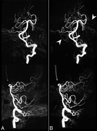 Fig 3.