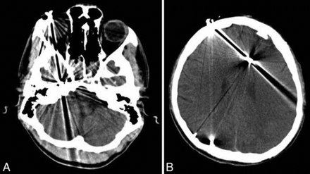 Fig 1.