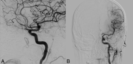 Fig 6.