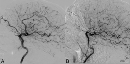 Fig 8.