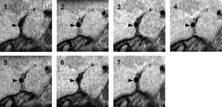 Fig 3.